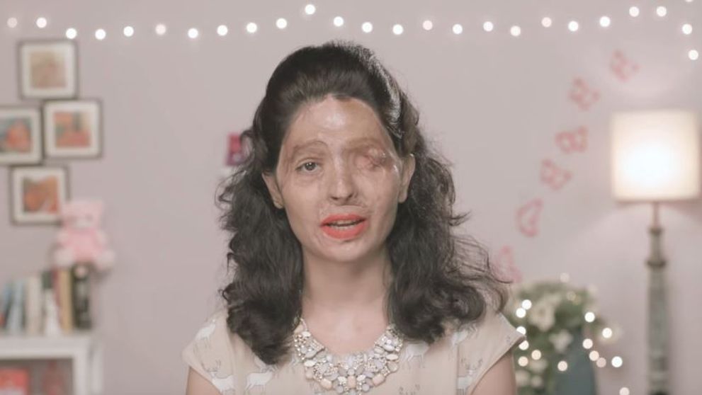 A fost arsa cu acid sulfuric la 17 ani. Un an mai tarziu, tutorialul sau de make-up transmite un mesaj cutremurator