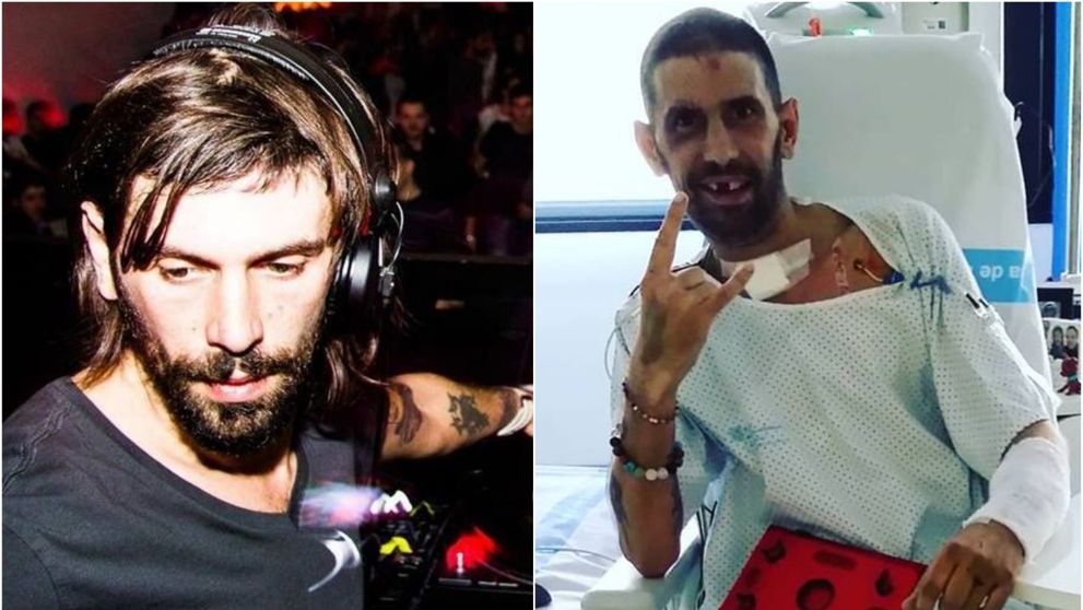 DJ Pagal s-a refăcut miraculos după accidentul de motocicletă. Prima poză din spital