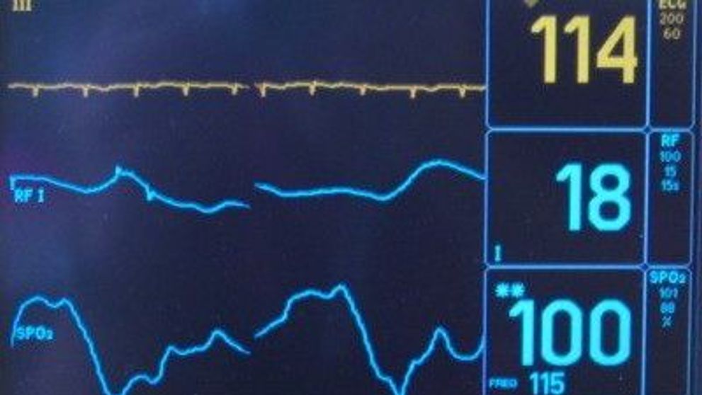 Decizia neasteptata a unei mame salveaza de la moarte un copil tinut in viata de aparate