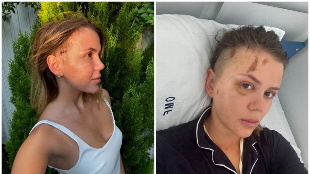 Emily Burghelea, schimbare radicală de look după accidentul grav din Mauritius: „Viața e prea scurtă ca să ne fie frică de schimbări”
