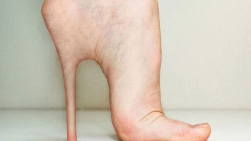 Noua inventie in materie de implanturi. Ti-ar dori astfel de picioare?