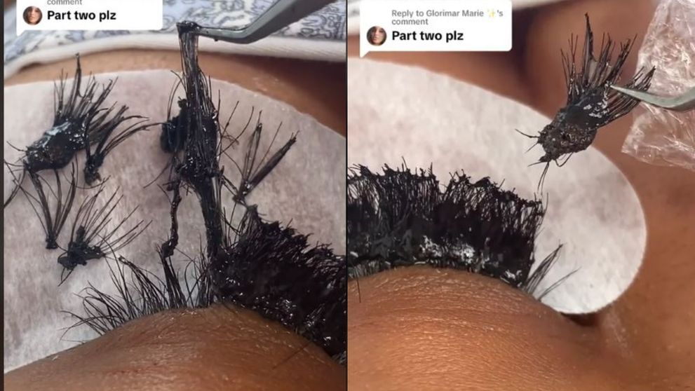 Dezastru total! Ce a pățit o femeie după ce și-a pus extensii de gene: “Nu vă imaginați cât de dureros poate fi!”