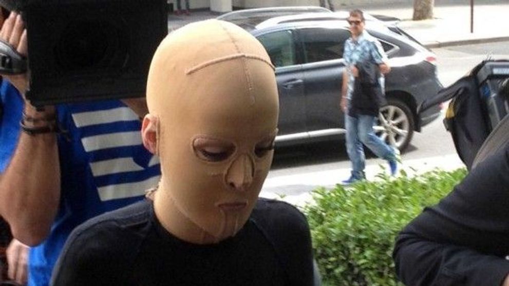 A purtat aproape 3 ani aceasta masca, acum merge zilnic pe strada fara ea. Cum arata chipul ei cu adevarat
