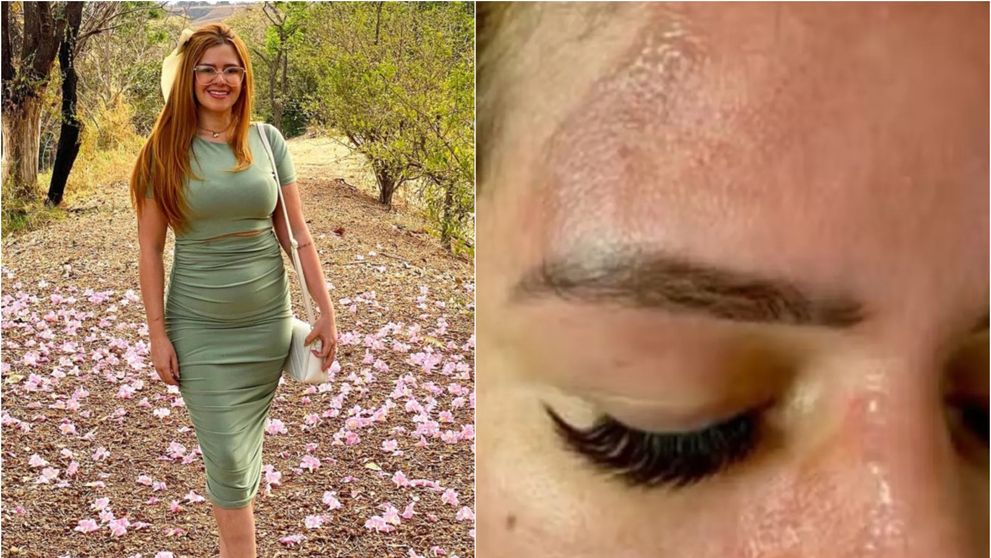 O celebră influenceriță, desfigurată după ce o oală sub presiune i-a explodat în față! Tânăra a fost la un pas de moarte: „Am apucat mânerul și...”
