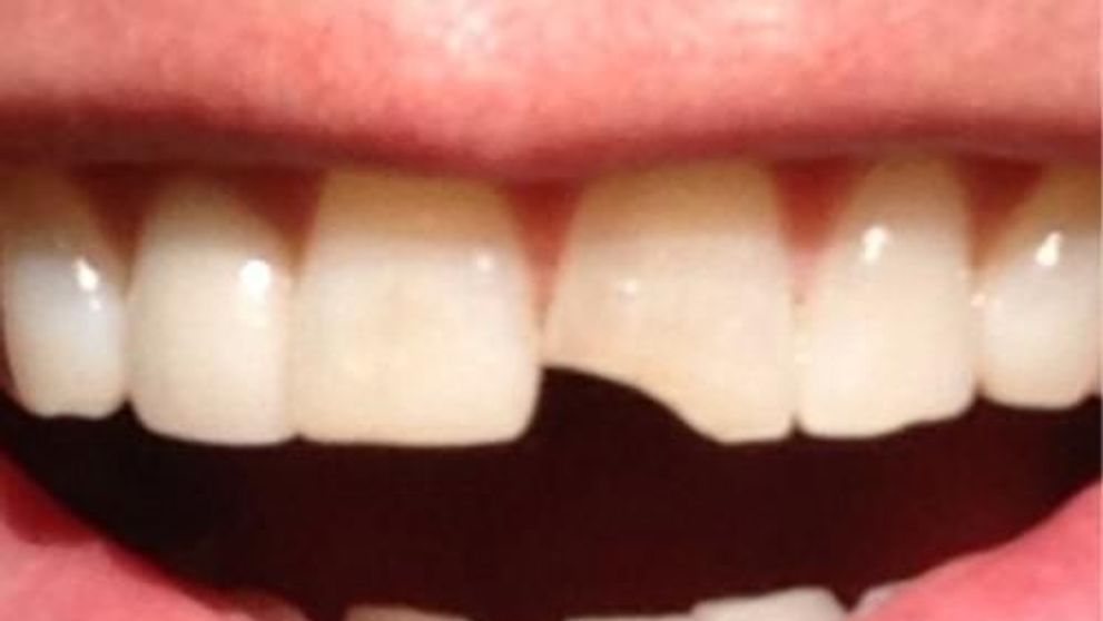 Il recunosti doar dupa dintii ciobiti? Jim Carrey a anuntat intr-un mod inedit continuarea faimoasei comedii 