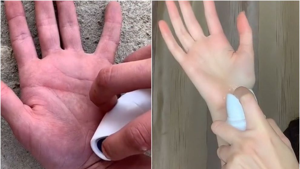 Deodorantul spray pe piele, o nouă provocare periculoasă pe TikTok! Tinerii se aleg cu arsuri grave și cicatrici pe viață