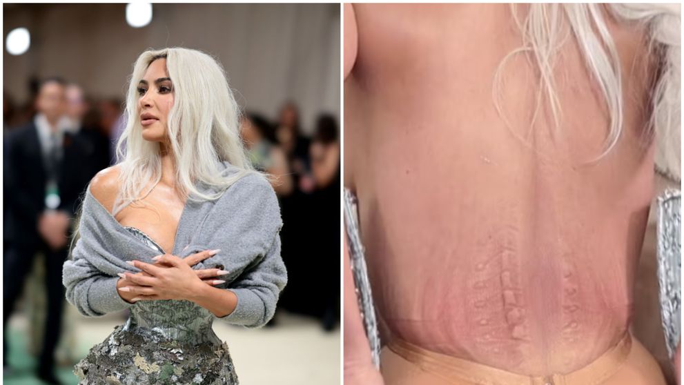 Urme adânci și piele vânătă! Kim Kardashian, marcată de rochia imposibilă de la Met Gala: „Nu am simțit atâta durere niciodată”