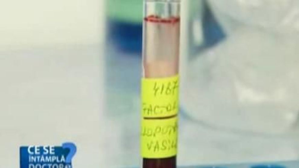Cancerul pulmonar: afla care sunt simptomele si metodele de tratament! VIDEO