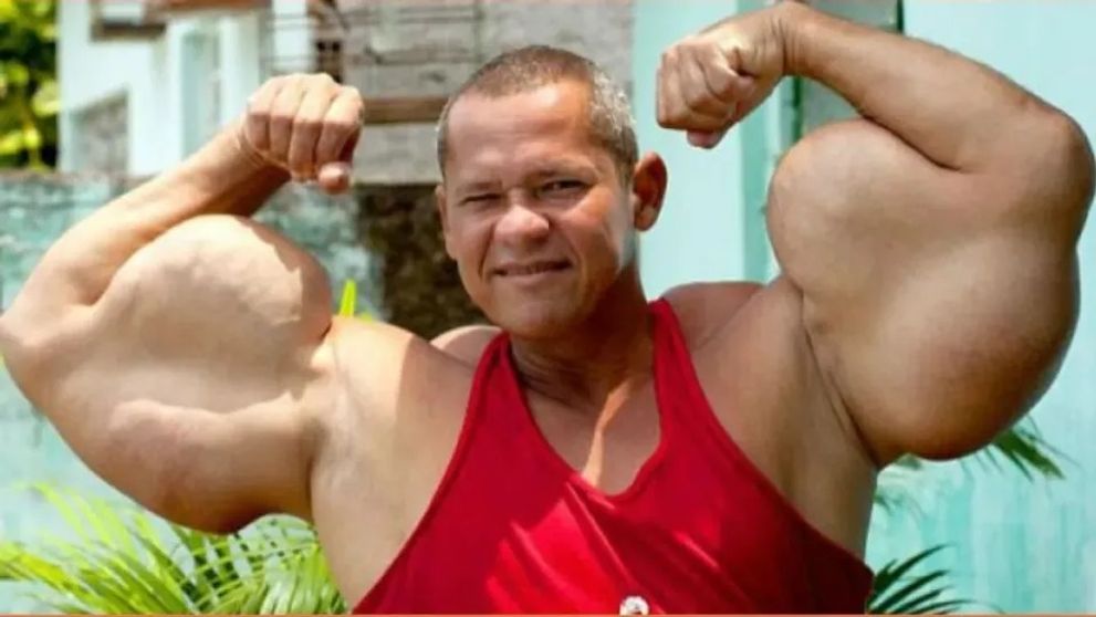 A murit culturistul supranumit „Adevăratul Popeye”! La 55 de ani avea bicepși de 73 de centimetri: „Nu sfătuiesc pe nimeni”. Care a fost cauza decesului