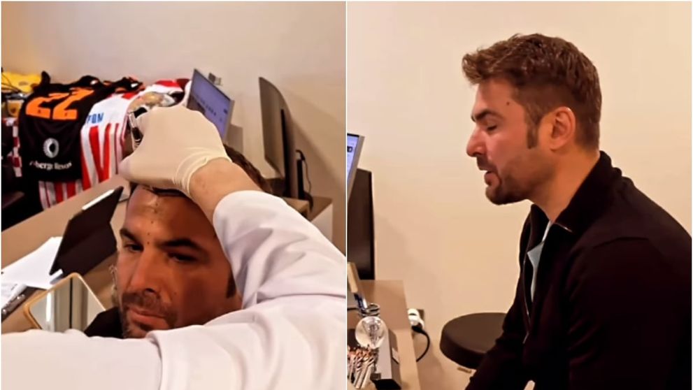 Cum arată Adrian Mutu după ce și-a făcut implant de păr! „Briliantul” a postat prima imagine la cinci luni de la intervenție