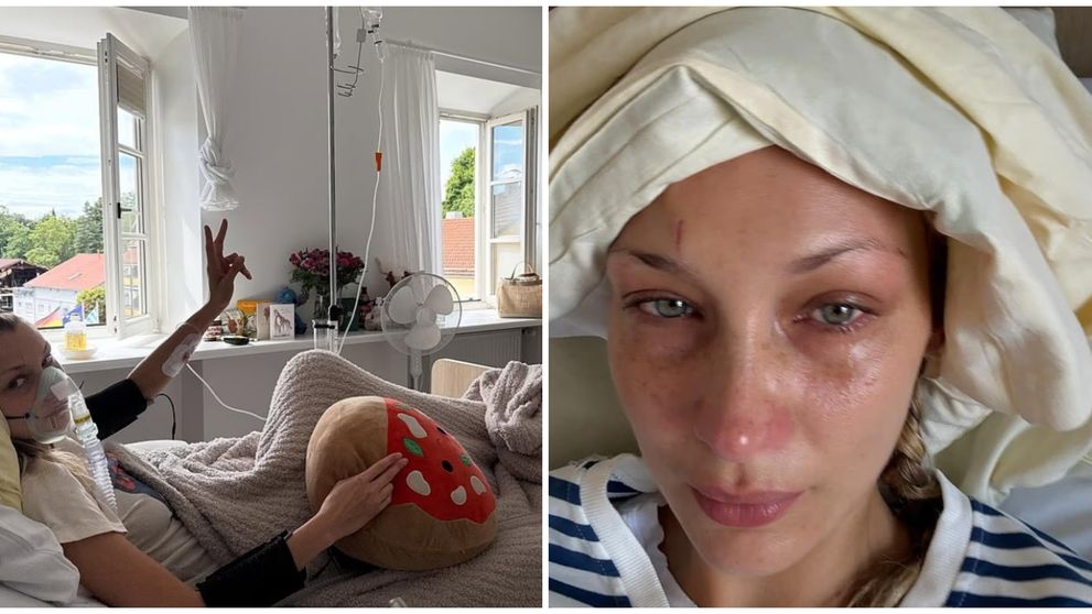 Bella Hadid și-a speriat fanii: a apărut cu lacrimi în ochi, cu o perfuzie în braț și cu un tub de oxigen pe patul de spital