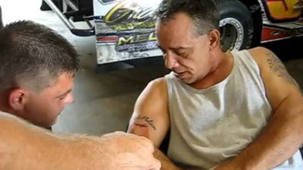Cea mai brutala modalitate de indepartare a unui tatuaj. Vezi despre ce este vorba! VIDEO