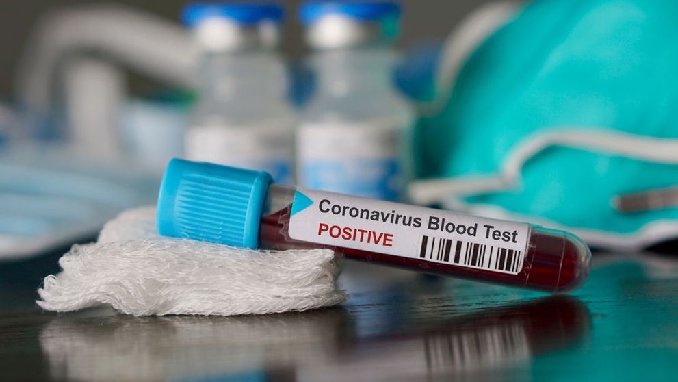 Coronavirus: De ce unii pacienții vindecați sunt testați, din nou, pozitiv