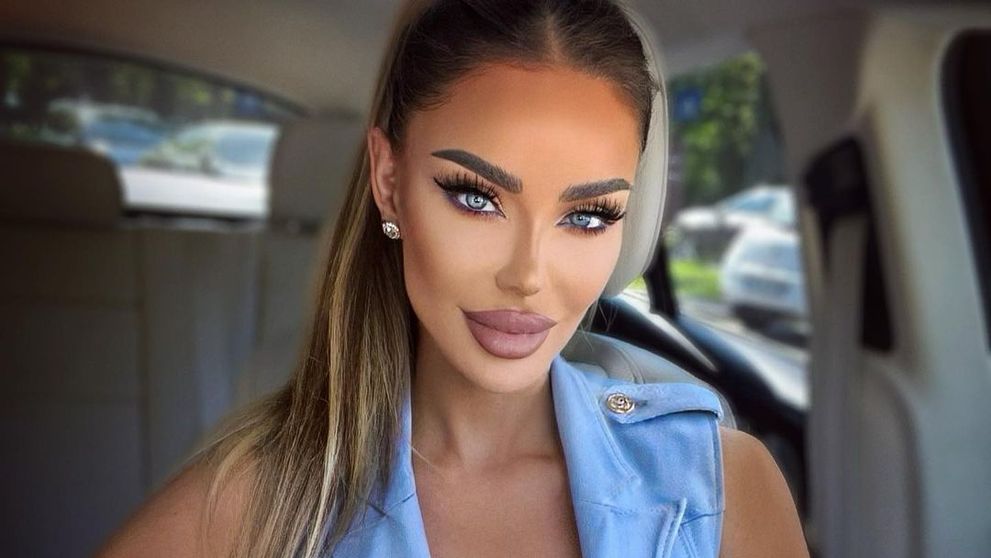 Bianca Drăgușanu își face operație de micșorare a sânilor. De ce a luat această decizie
