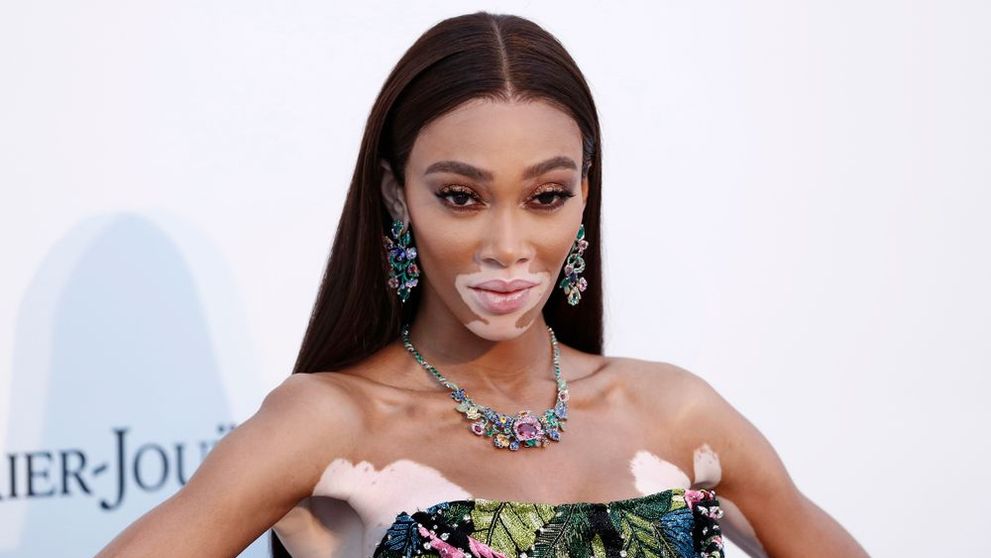 Winnie Harlow, apariție spectaculoasă pe Instagram. Cum a pozat celebrul modelul cu vitiligo