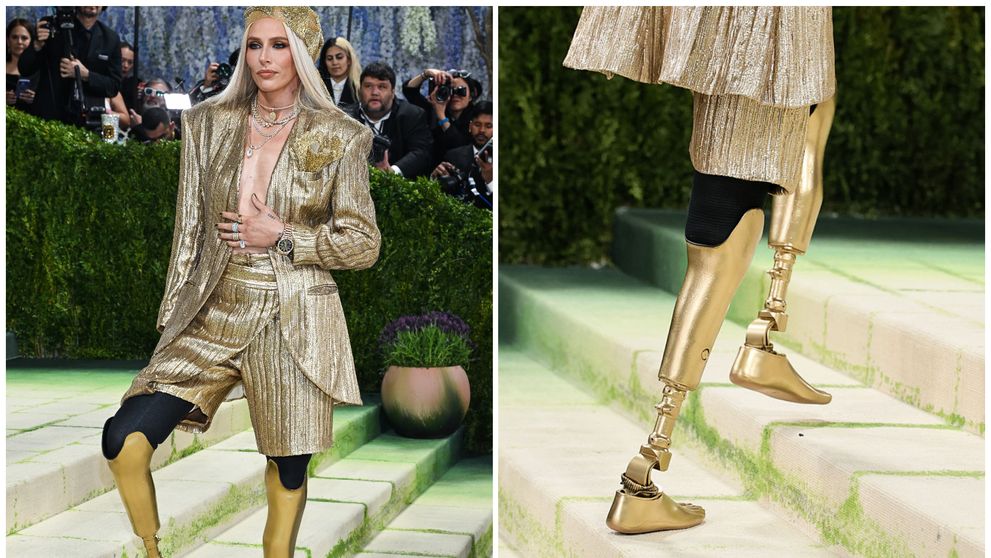 Cine este „fata cu picioarele de aur”, care a impresionat la Met Gala 2026. Și-a pierdut ambele picioare din cauza unei afecțiuni rare