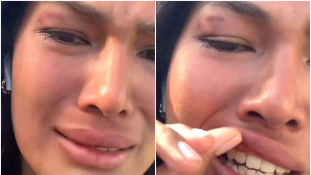 Influenceriță celebră, bătută cu bestialitate pe stradă! Tânăra a ajuns la spital după ce a fost lovită fără milă în față: „Îmi e frică să mai ies”