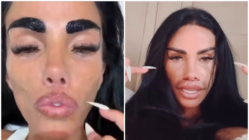 ”Buzele mele arată prea subțiri”. La 48 de ani, Katie Price, victima operațiilor estetice nereușite. Reacția fanilor: ”E timpul să-ți îmbrățișezi vârsta”