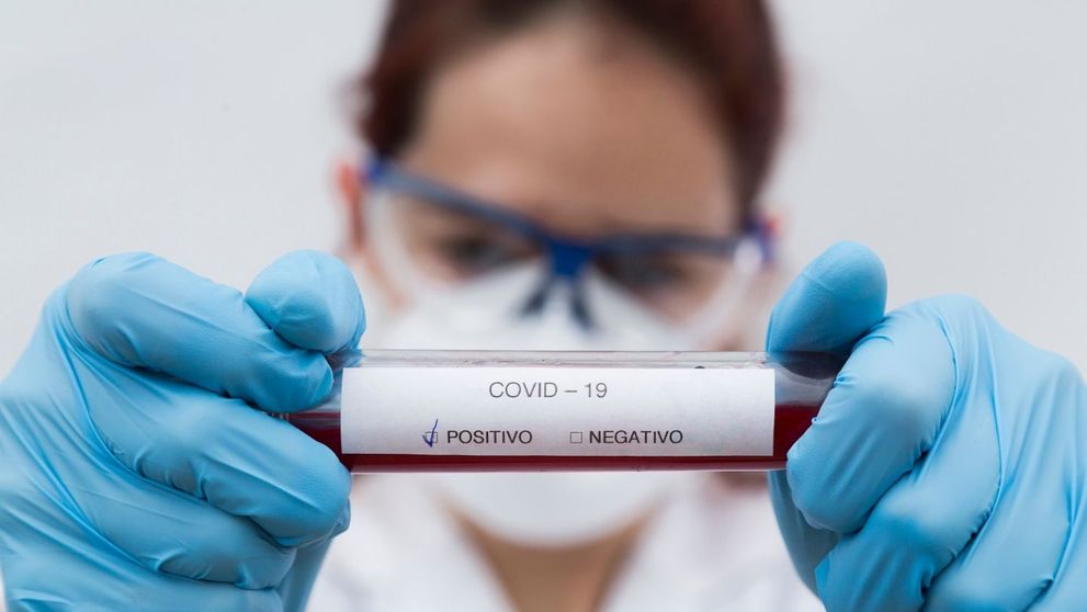 Coronavirus | Autoritățile spaniole, dezamăgite de performanța slabă a testelor rapide din China