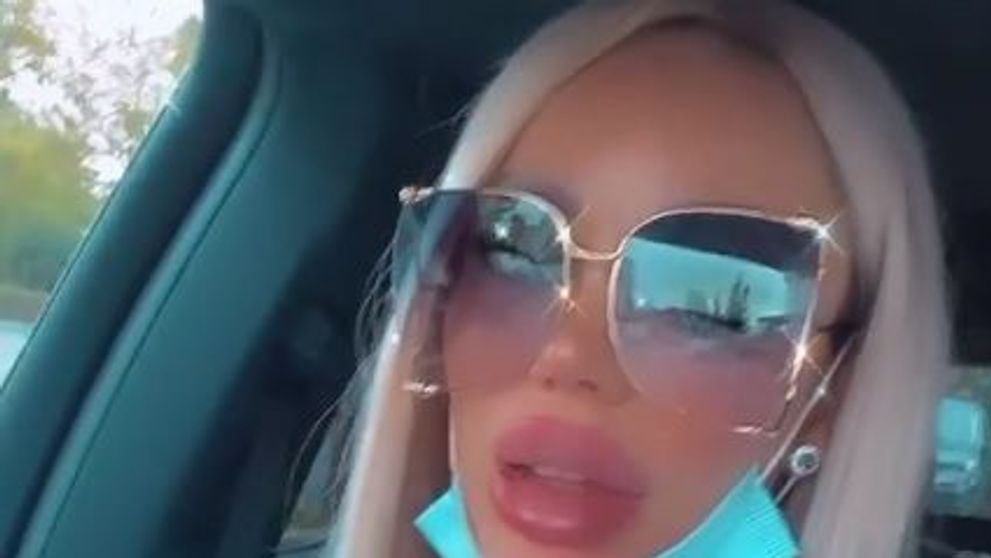 Bianca Drăgușanu, agresată de iubitul ei! Imagini șocante cu vedeta plină de vânătăi