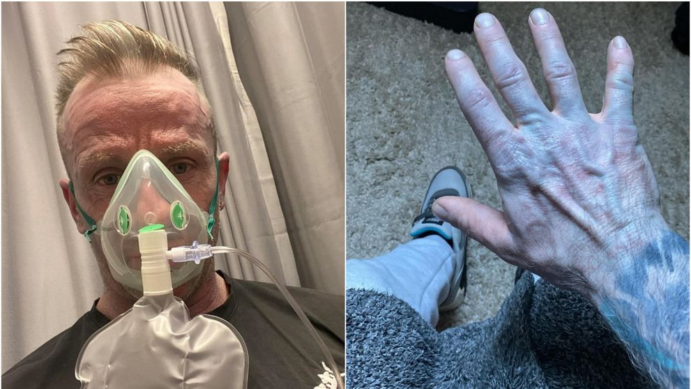 S-a trezit albastru din cap până în picioare și a fugit la spital. Când au descoperit cauza, medicii au început să râdă: 