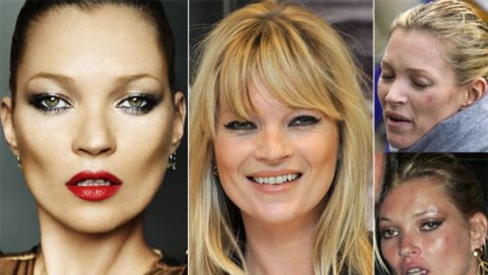 Kate Moss: declinul unei frumuseti emblematice. Cum au distrus-o tigarile, drogurile si petrecerile non-stop