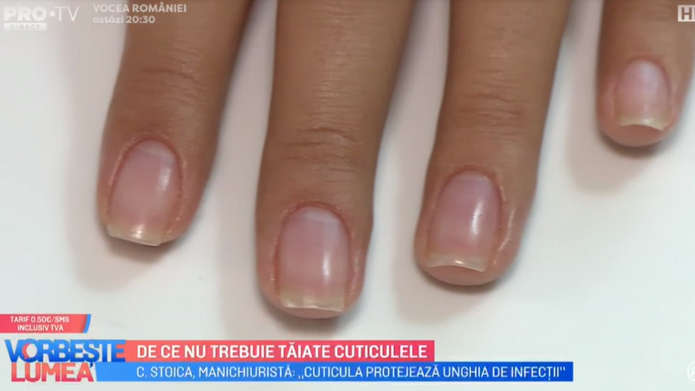 De ce nu trebuie tăiate cuticulele ne explică Dr. Cătălina Stoica