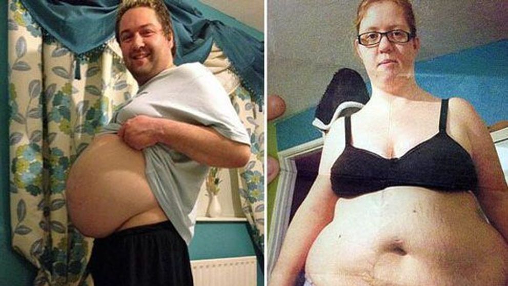 Au fost dependenti de fast food si uite cum au ajuns. Un accident stupid i-a motivat sa scape de kilogramele in plus: FOTO