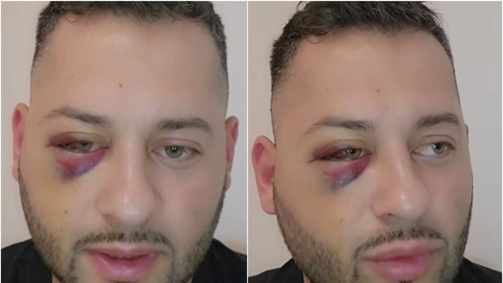Fostul preot Daniel Balaș a fost desfigurat în bătaie: „Mi-au provocat trei fracturi, la maxilar, sinusuri și la osul de sub ochi”
