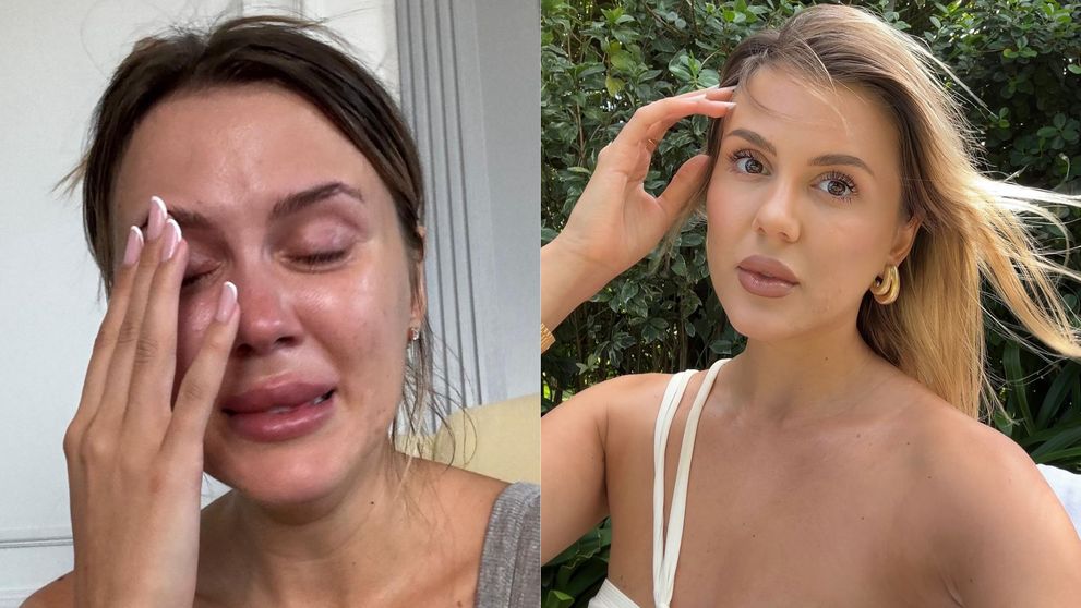 Emily Burghelea a cedat! Influencerița a izbucnit în lacrimi pe Internet: „Doare foarte tare” Cu ce se confruntă