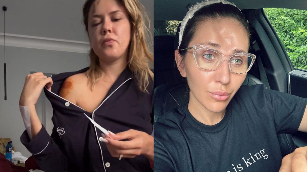 Emily Burghelea, ironizată de Dana Roba, în urma accidentului care era să o omoare. Make-up artista i-a lăsat un comentariu care i-a scos din minți pe fanii acesteia: „Să-ți fie rușine”