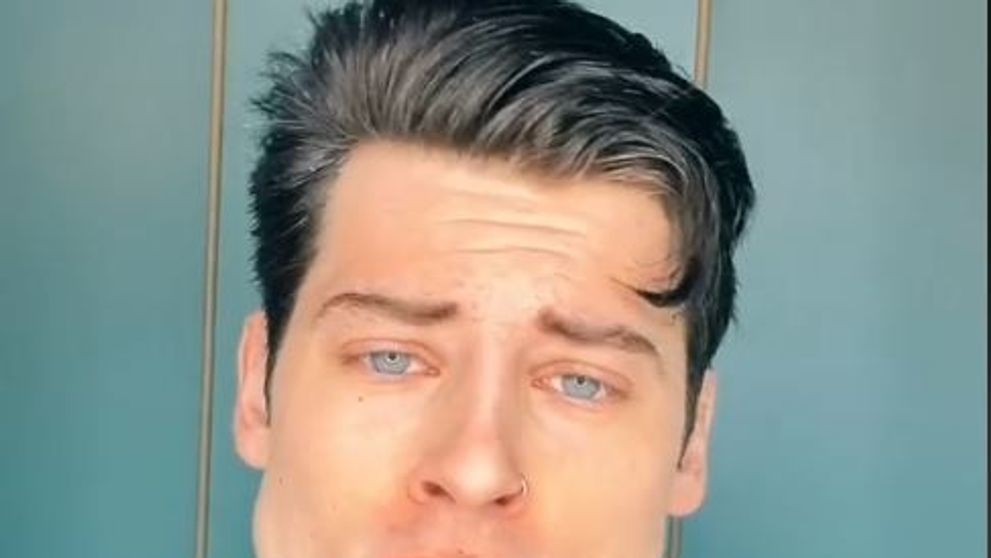Luca Marchesi, modelul care în două luni și-a mărit maxilarul, fără intervenții estetice. Cum a reușit