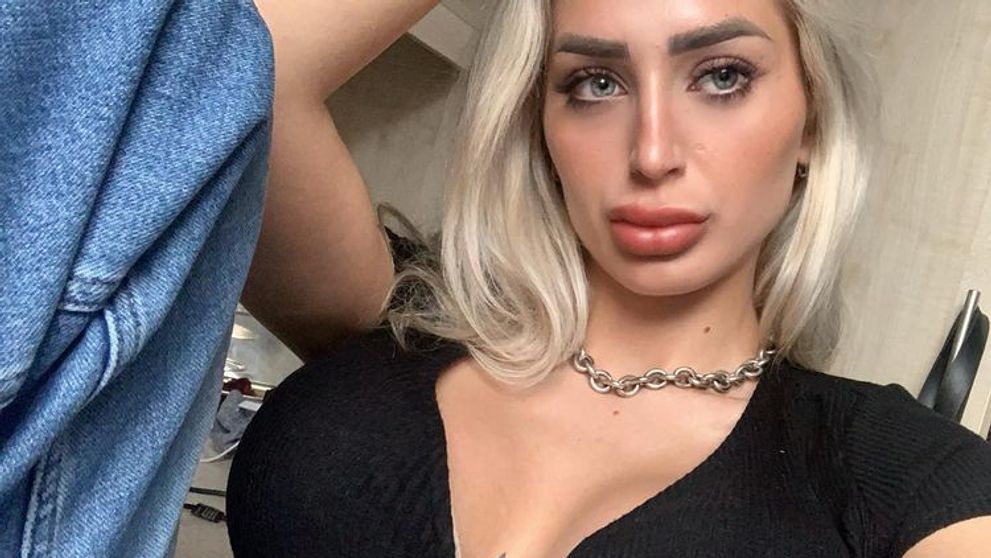 Ce s-a întâmplat cu un model OnlyFans care a urcat în avion, după ce a suferit o operație estetică