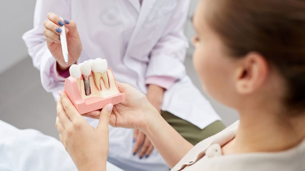 (P) Tipuri de implant dentar și etapele realizării unei astfel de intervenții