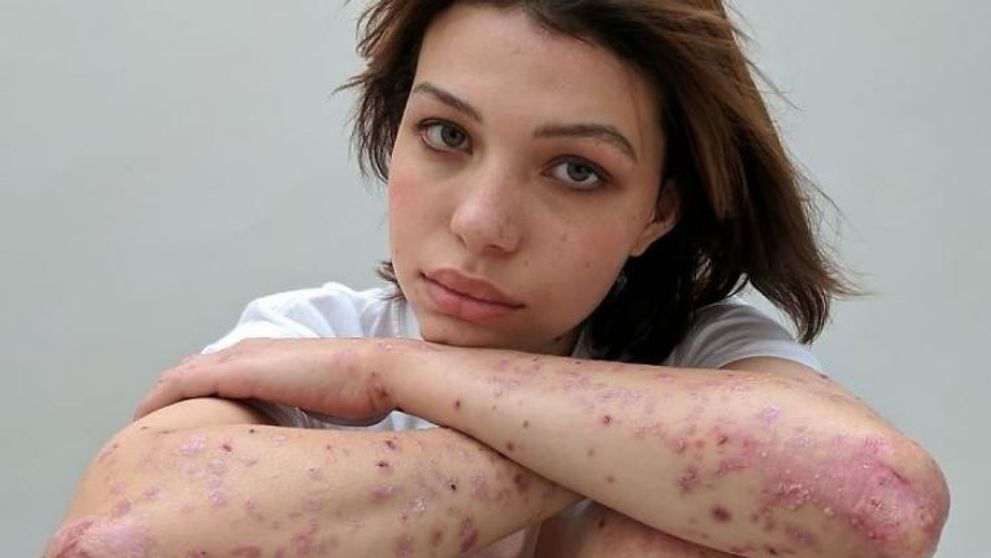 Oamenii si-au expus cicatricele intr-un proiect foto impresionant. Sunt genul de imagini care nu pot trece neobservate