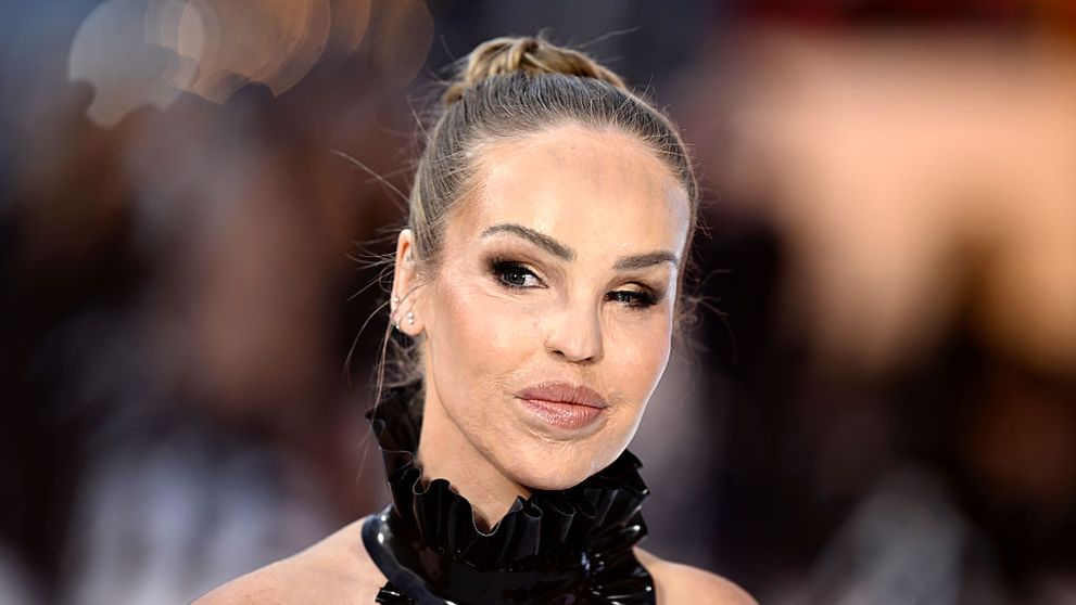 Bărbatul care i-a distrus viața și a desfigurat-o cu acid ar putea fi eliberat!  Katie Piper trăiește și azi cu durere și operații fără sfârșit: are peste 200 de intervenții, iar coșmarul continuă