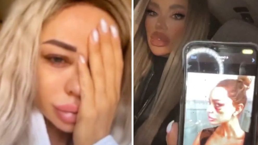 Bianca Drăgușanu, imagini șocante! A publicat poze după ce a fost bătută cu bestialitate în nenumărate rânduri