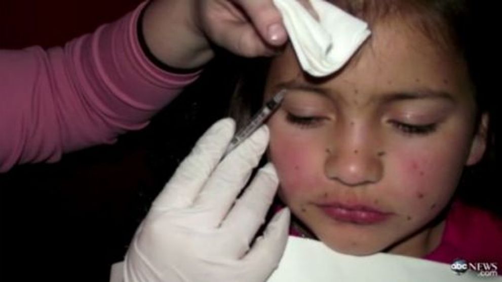 Mama care isi injecta fiica de 8 ani cu Botox, pedepsita! Protectia Copilului a intervenit