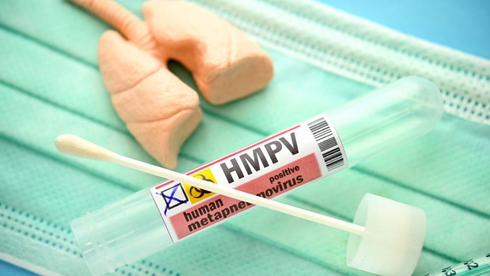 Rafila: „Zeci de mii de cazuri de metapneumovirus neconfirmate în România”. Recomandările INSP pentru prevenirea îmbolnăvirilor cu HMPV