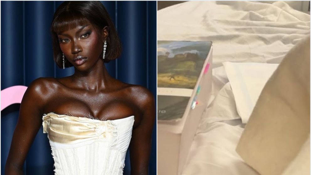 Boala nu iartă pe nimeni! Supermodelul care a înnebunit internetul și câștigă o avere a ajuns pe mâinile medicilor! Tânăra se confruntă cu o gravă problemă de sănătate: „Trebuie să mă opresc”. Imagini de pe patul de spital
