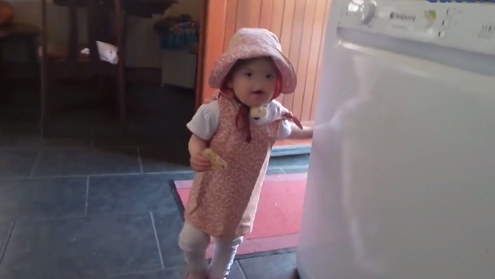 Fetita care a uimit intreaga lume. S-a nascut fara nas, dar este extraordinar de simpatica