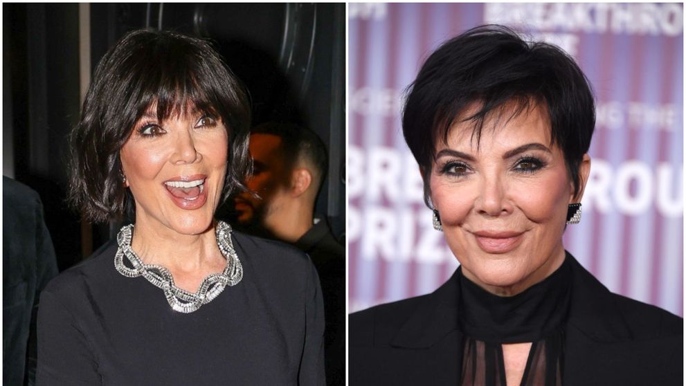 Faceliftingul de 100.000 $ care a șters două decenii de pe chipul ei: Kris Jenner, transformare fabuloasă la 69 de ani! Iubitul cu 25 de ani mai tânăr, încântat