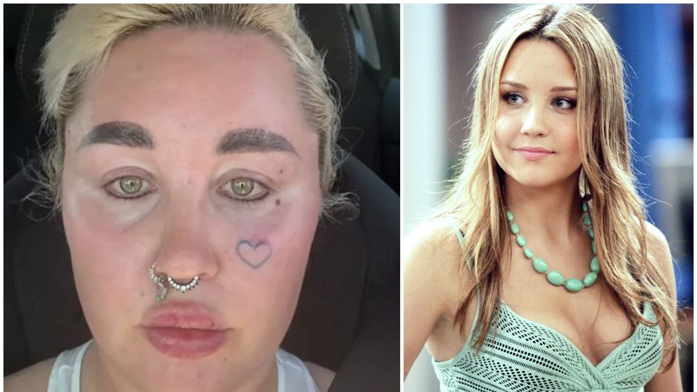 Amanda Bynes, fostul idol al adolescenților, are un nou look surprinzător. Ce intervenție și-a făcut la față