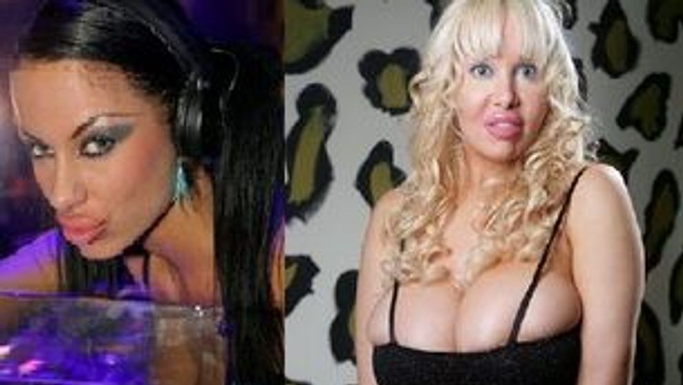 Buze marite cu silicon, botox sau colagen: sexy sau dezgustatoare? FOTO