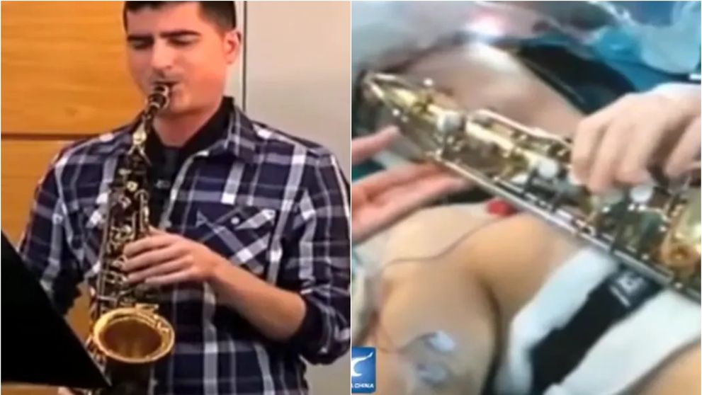 A murit Carlos Aguilera, artistul care a cântat la saxofon 12 ore, în timp ce era operat pe creier! Ce s-a întâmplat cu bărbatul care a șocat lumea întreagă