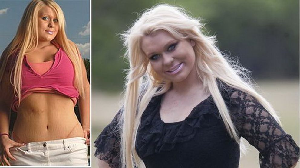 La numai 12 ani si-a facut liposuctie, iar pana la 17 si-a pus inel gastric si silicoane...ca sa arate ca papusa Barbie!  