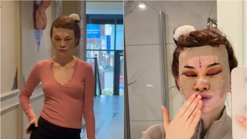 Antonia a apelat la operațiile estetice și și-a mutilat fața, după ce oamenii au comparat-o cu personajele din The Simpsons! Ce a pățit o celebră influenceriță de doar 28 de ani: „Nu ai avut nevoie de asta!”