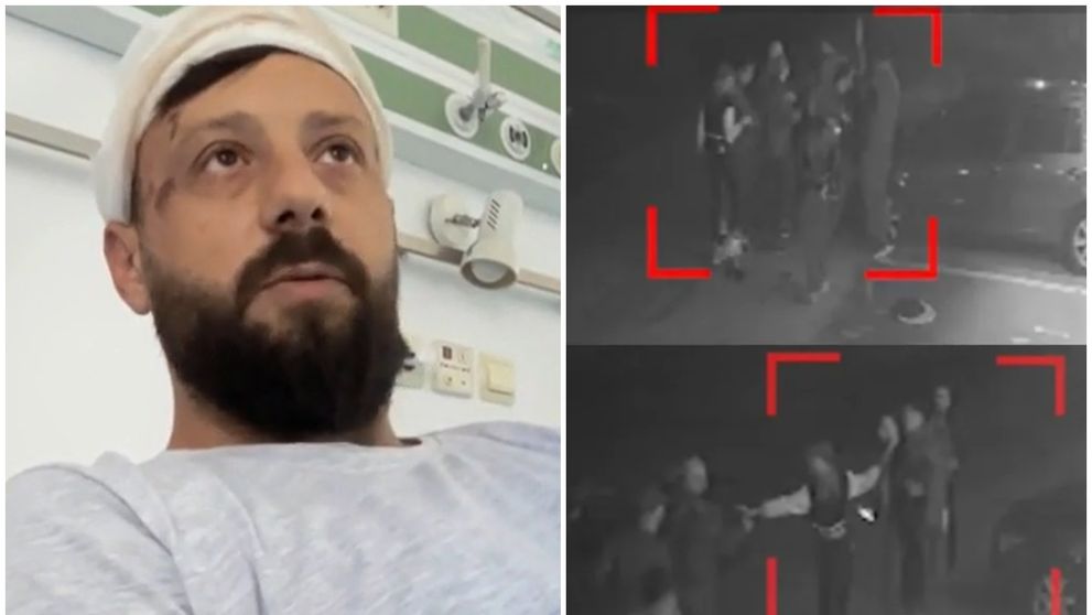Valentin, un tânăr în vârstă de 29 de ani, a fost ținut cu forța și lovit cu un ciocan în cap, de nenumărate ori! Scenele de groază au fost surprinse de o cameră de supraveghere: „Puteam să paralizez”