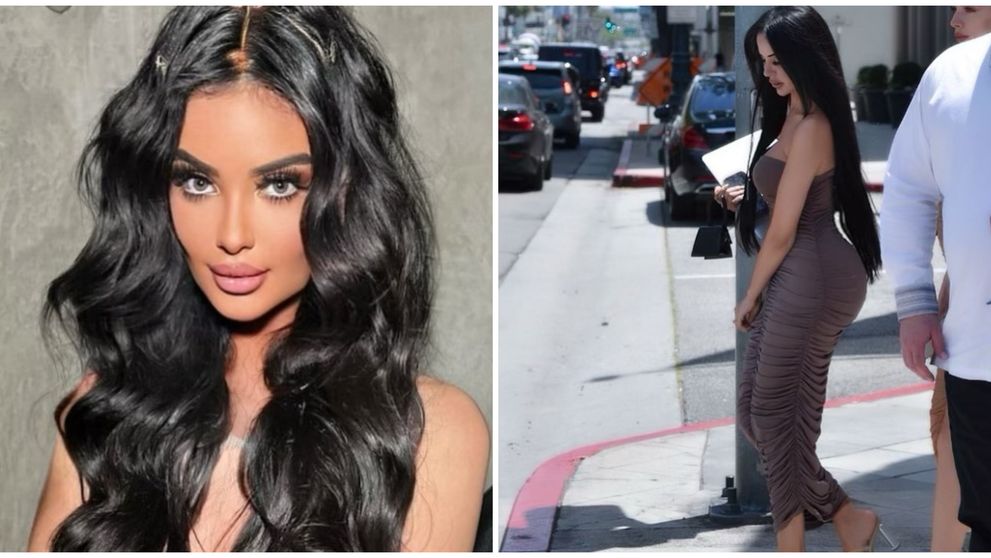 A cheltuit peste 1 milion de dolari ca să arate precum Kim Kardashian, însă medicii i-au dat un verdict crunt după numeroasele proceduri și operații estetice