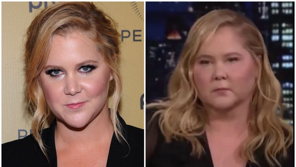 Amy Schumer și-a îngrijorat fanii. Ce explicație a dat pentru fața ”umflată și buhăită” din ultima apariție la TV